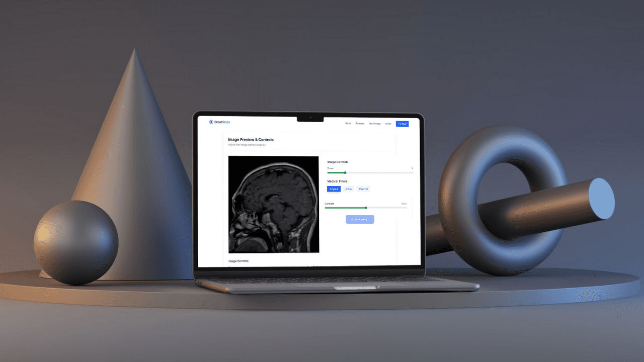 Brain Tumor Detection and Segmentation